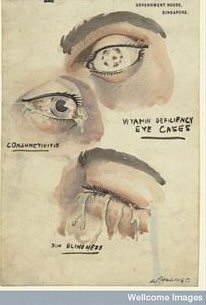 Eye Diseases Poster